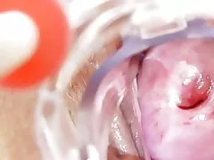 Mocskos nővér kap solo